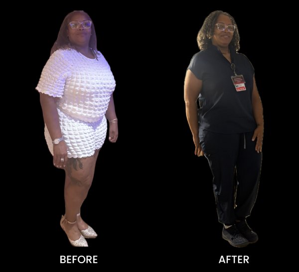 Before and After Images of Patient at OptiCore Health and Wellness in Belmont, NC
